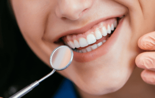 manchas-dentales-drvilar